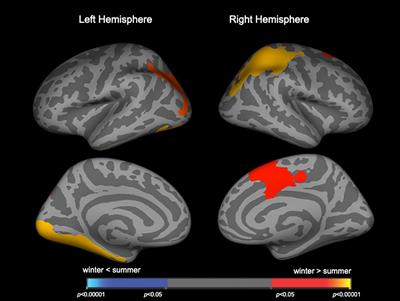 Increased brain gyrification and cortical thinning in winter-born patients with schizophrenia spectrum